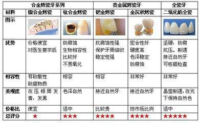 金合金烤瓷牙价格一颗多少钱
