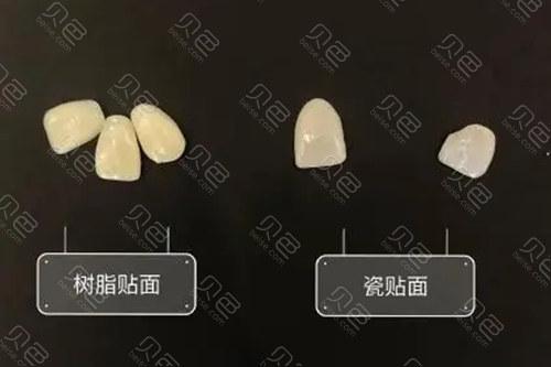 烤瓷牙树脂贴面
