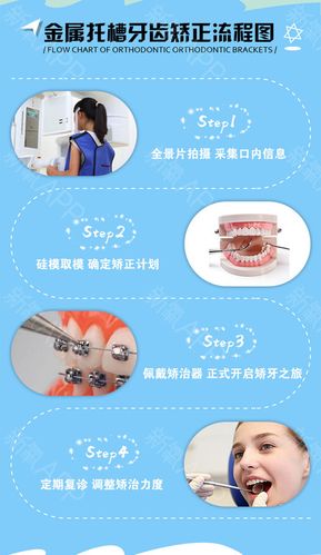 自锁托槽牙套